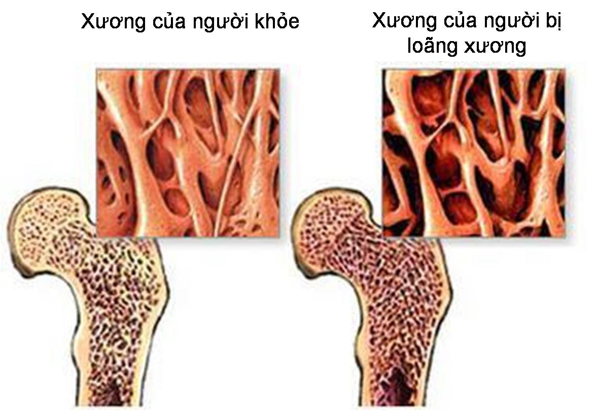 5 lợi ích khi thực hiện bài tập ngồi xổm dựa tường mỗi ngày- Ảnh 2. 5 lợi ích khi thực hiện bài tập ngồi xổm dựa tường mỗi ngày- Ảnh 2.