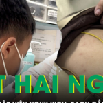 Bé trai 7 tuổi nhập viện nguy kịch sau hai ngày sốt, bạch cầu tăng 8 lần
