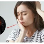 Không chủ quan với dấu hiệu nhận biết trật khớp thái dương hàm