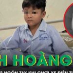 Kinh hoàng: Bé trai 5 tuổi đứt lìa 2 ngón tay khi chơi xe điện tự chế