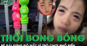 Chơi bong bóng xà phòng, bé gái 5 tuổi sưng đỏ 2 mắt phải cấp cứu khẩn