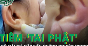 Tiêm filler làm ‘tai Phật’ ở spa, cô gái trẻ gặp biến chứng nghiêm trọng