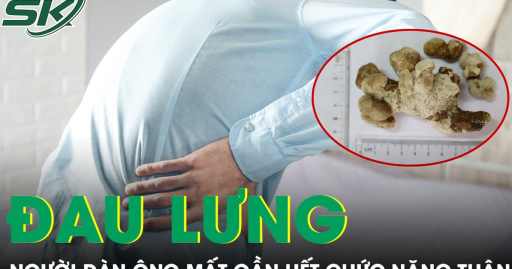 Người đàn ông mất gần hết chức năng thận do chủ quan với dấu hiệu đau lưng