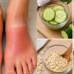 5 cách tự nhiên giúp làm dịu, cải thiện tình trạng cháy nắng ở bàn chân