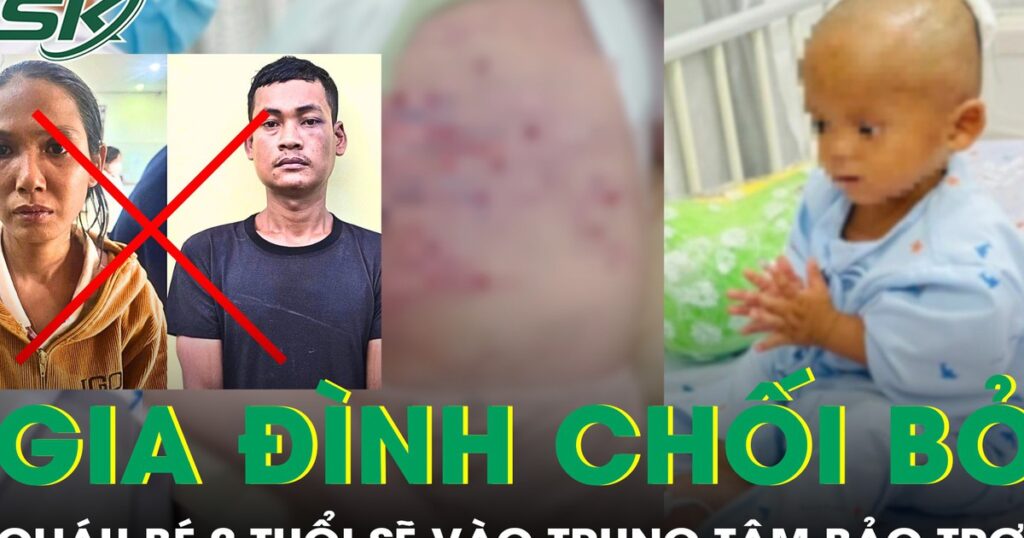 Gia đình chối bỏ chăm sóc, cháu bé 2 tuổi bị mẹ và nhân tình bạo hành sẽ vào trung tâm bảo trợ xã hội