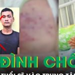 Gia đình chối bỏ chăm sóc, cháu bé 2 tuổi bị mẹ và nhân tình bạo hành sẽ vào trung tâm bảo trợ xã hội