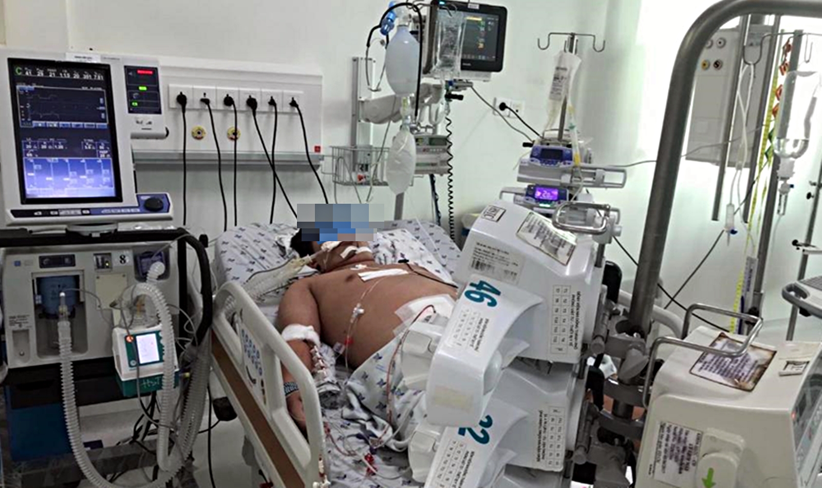 Đầu mùa mưa, nhiều giải pháp được triển khai nhằm giảm số ca sốt xuất huyết nặng- Ảnh 3.