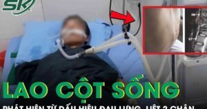 Đau lưng kéo dài nhưng chủ quan, người đàn ông bất ngờ liệt hai chân vì lao cột sống