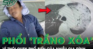 Tưởng cảm cúm, người đàn ông bất ngờ suy đa tạng, phổi ‘trắng xoá’ vì thói quen nhiều người mắc