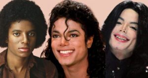 Sự thật về căn bệnh hiếm khiến Michael Jackson phải tẩy trắng da