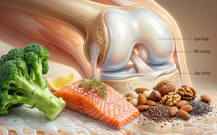 5 loại thực phẩm tốt nhất cho xương khớp khỏe mạnh