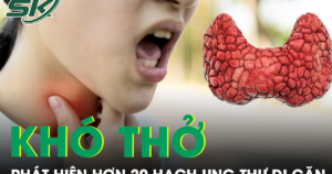 Khó thở mất tiếng, người phụ nữ phát hiện hơn 20 hạch ung thư di căn