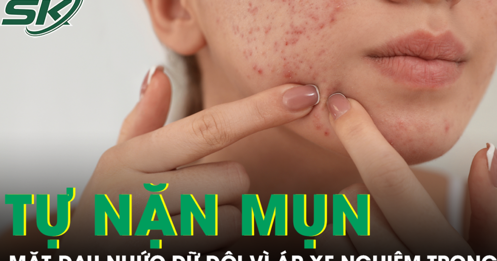 Tự nặn mụn quanh môi, cô gái nhập viện vì áp xe mặt, nhiễm vi khuẩn kháng thuốc