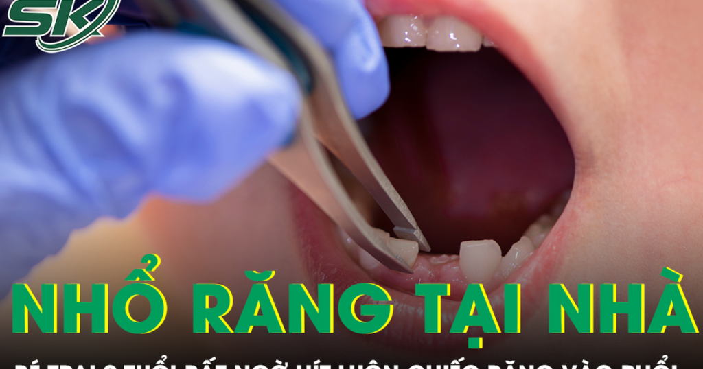 Được mẹ nhổ răng tại nhà, bé trai 9 tuổi bất ngờ hít luôn chiếc răng vào phổi