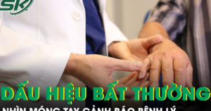 6 dấu hiệu bất thường ở móng tay có thể cảnh báo bệnh lý nguy hiểm