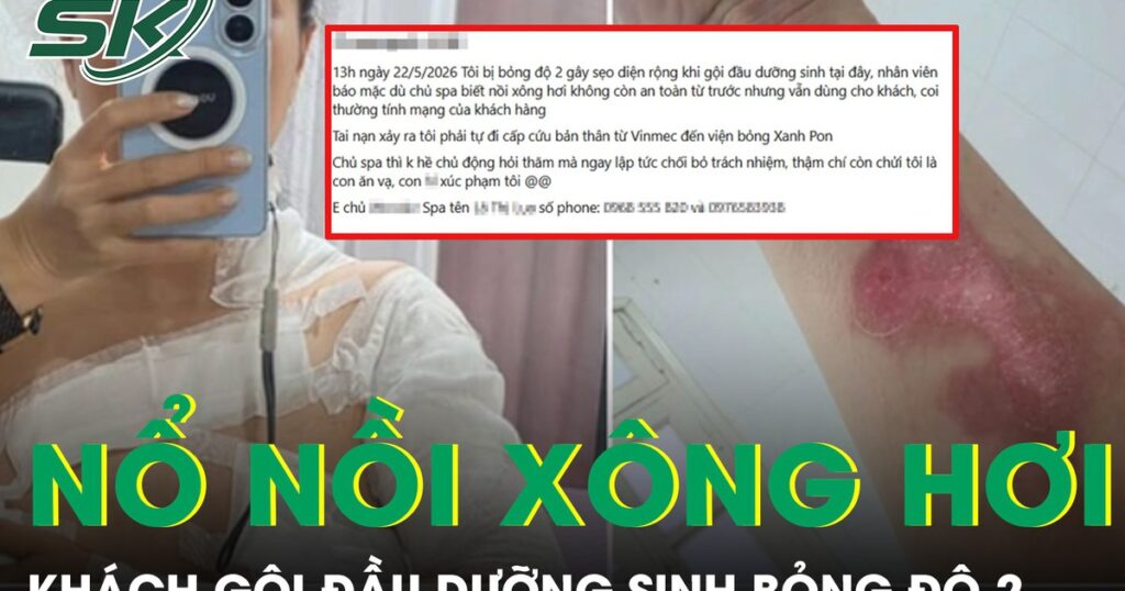 Nổ nồi xông hơi khi gội đầu dưỡng sinh, nữ khách bỏng độ 2 vùng cổ và ngực