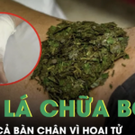 Đắp lá chữa bỏng, người đàn ông tiểu đường suýt mất cả bàn chân