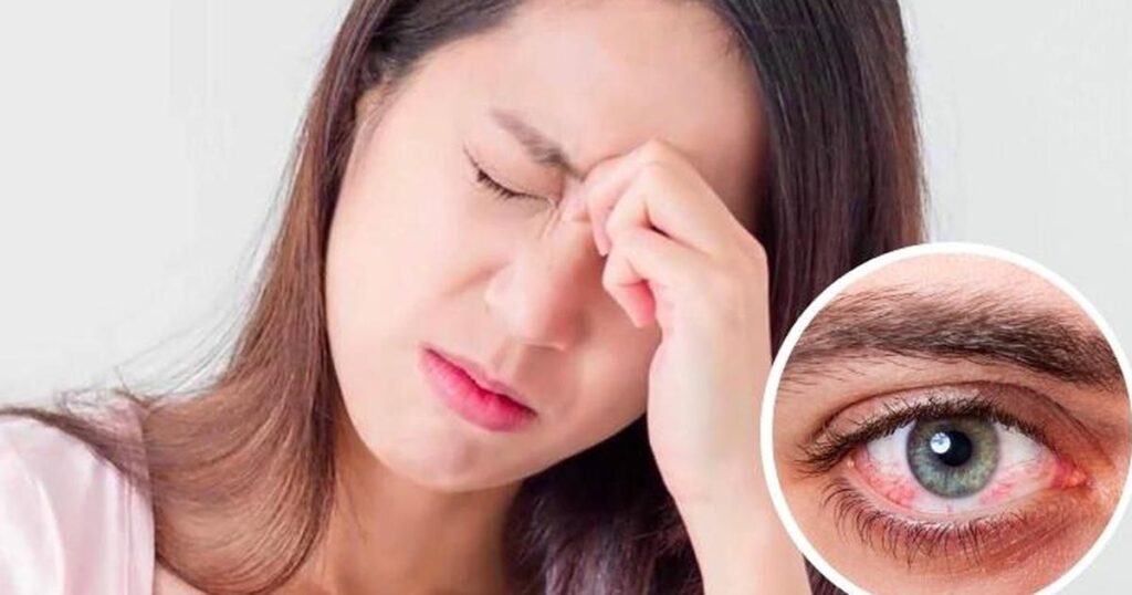 Đau hốc mắt cảnh báo bệnh gì?