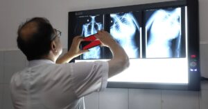 Dấu hiệu nhiều phụ huynh bỏ qua khiến trẻ biến dạng cột sống