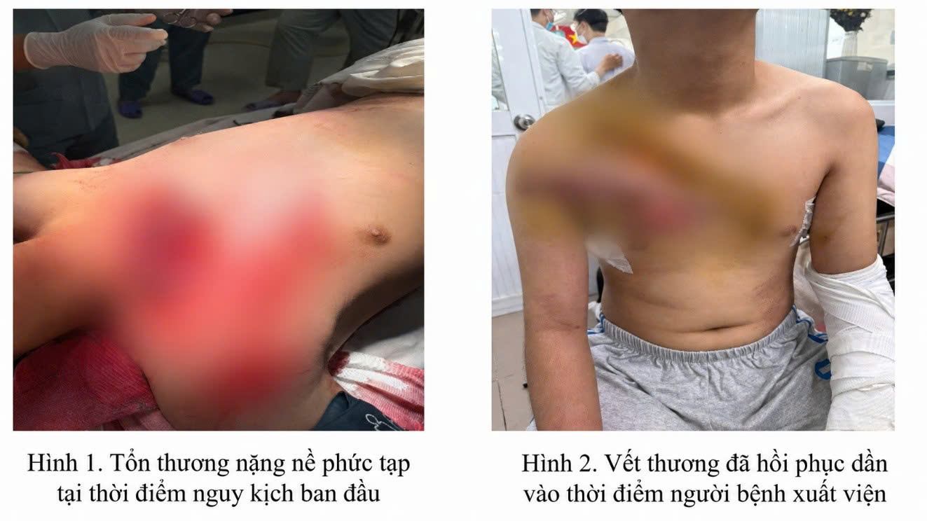 Bộ đôi ‘báo động đỏ liên viện’ và bác sĩ luân phiên cứu nhiều ca nguy kịch ở TPHCM- Ảnh 2.