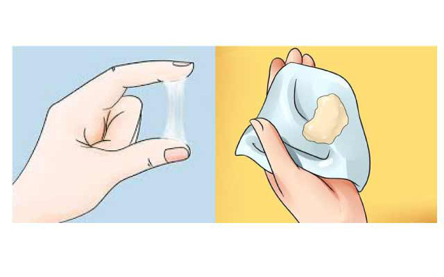 Phân biệt dịch âm đạo lành tính và bệnh lý