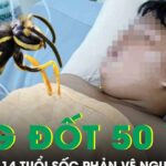 Bị ong vò vẽ đốt hơn 50 vết, thiếu niên 14 tuổi hoại tử, sốc phản vệ nguy kịch