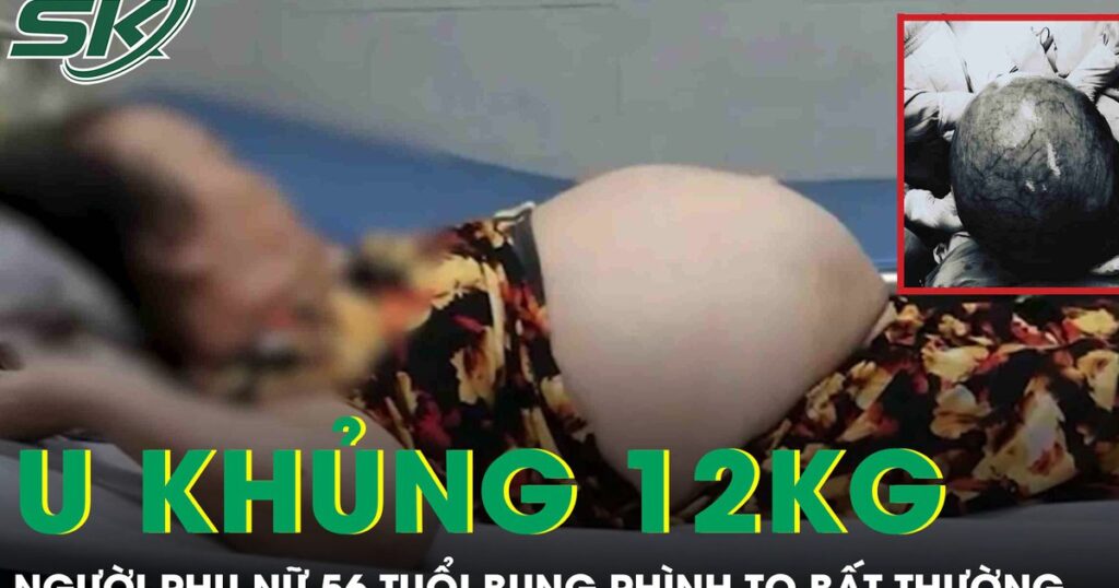 Bụng to bất thường, người phụ nữ ‘khóc ngất’ khi phát hiện khối u khổng lồ nặng tới 12kg