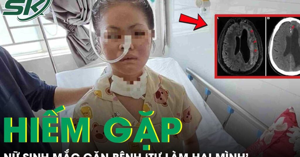 Nữ sinh 19 tuổi mắc căn bệnh ‘tự làm hại mình’ hiếm gặp