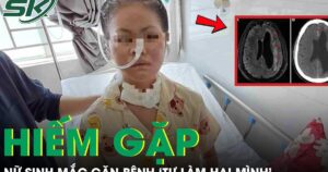 Nữ sinh 19 tuổi mắc căn bệnh ‘tự làm hại mình’ hiếm gặp
