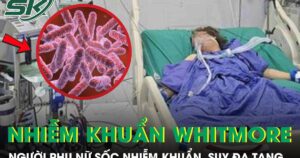 Người phụ nữ 43 tuổi sốc nhiễm khuẩn, suy đa tạng sau 5 ngày sốt
