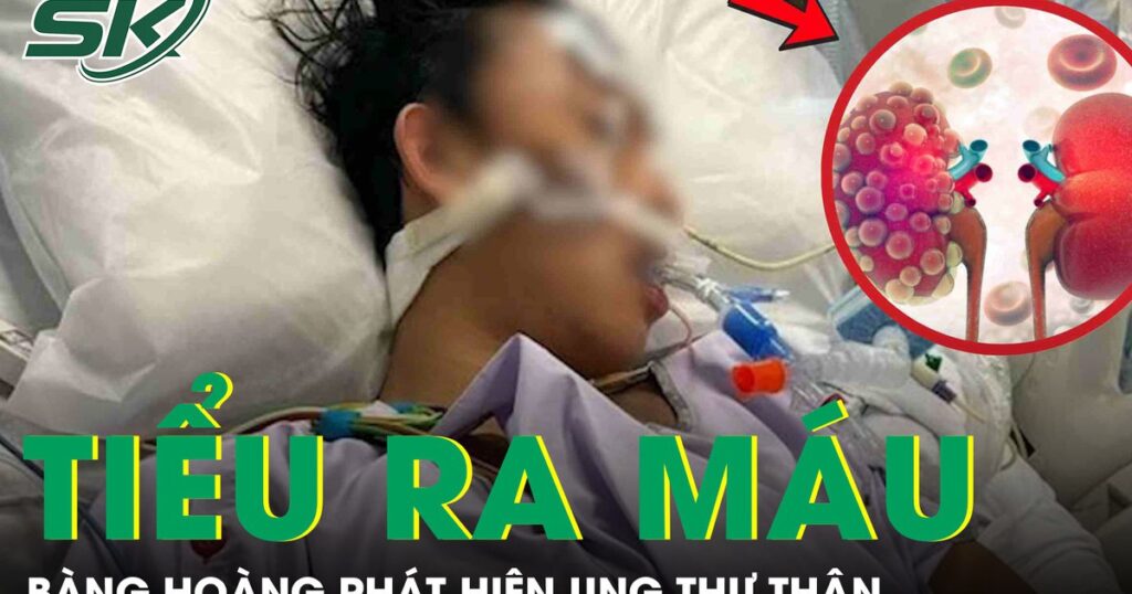 Người đàn ông 51 tuổi bàng hoàng phát hiện ung thư thận từ dấu hiệu tiểu ra máu