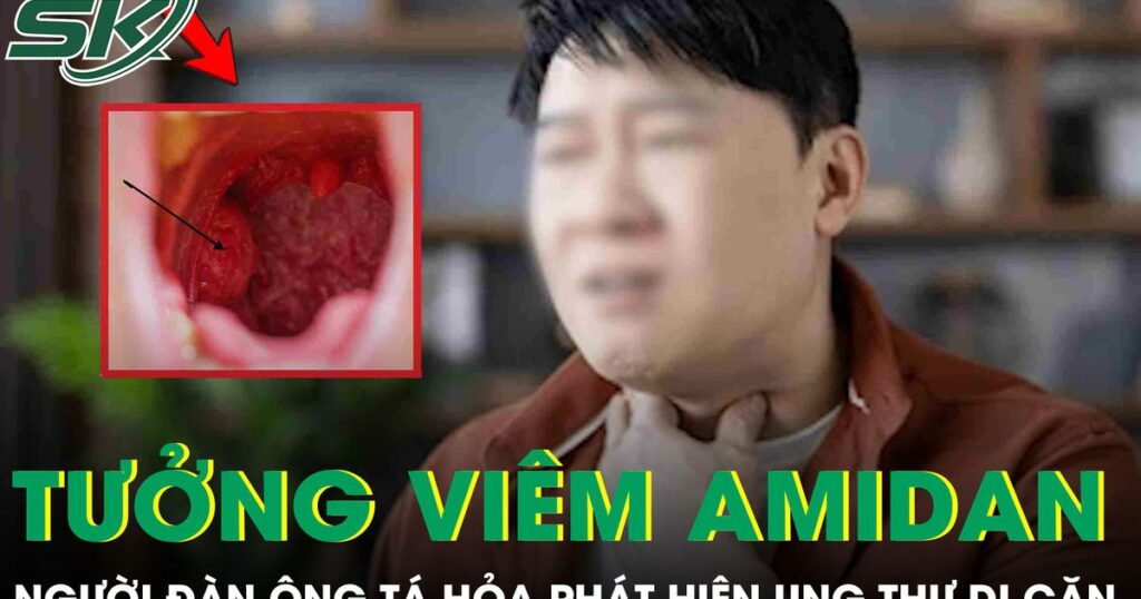 Tưởng viêm amidan, người đàn ông 60 tuổi ‘chết lặng’ phát hiện ung thư di căn