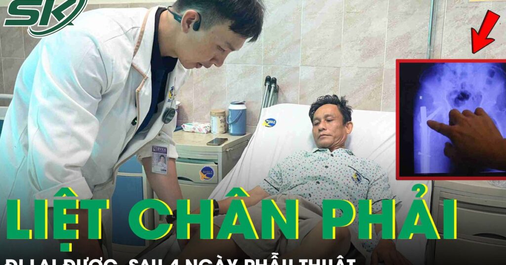 Ngã từ trên xe tải, bệnh nhân may mắn thoát nguy cơ liệt chân nhờ kỹ thuật đóng đinh chống xoay PFNA