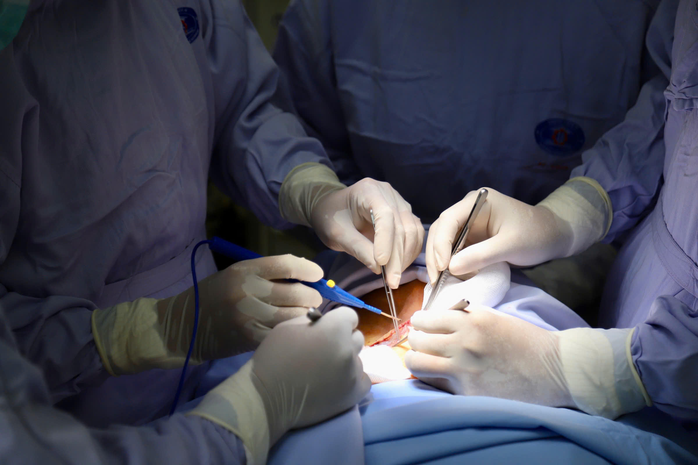 Ung thư lưỡi dễ nhầm nhiệt miệng: Bác sĩ cảnh báo dấu hiệu không nên chủ quan- Ảnh 1.