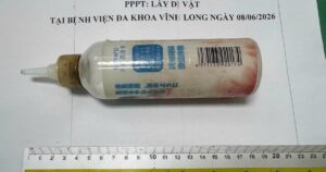 Chai nhựa dài 20cm mắc sâu trong trực tràng sau hành động tự xử của người đàn ông